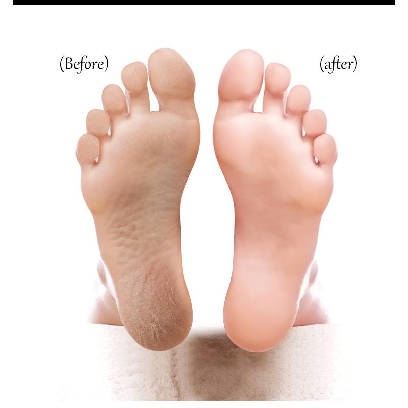 Hot Selling Foot File Exfoliating Callus Remover Double Sided Foot Scrubber File Callus Remover For Feet