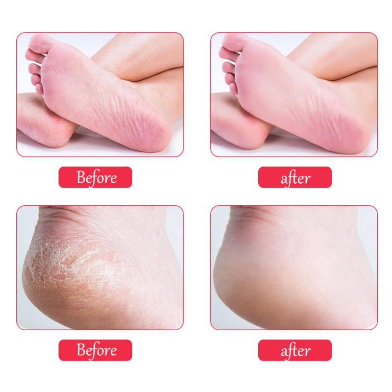 Hot Selling Foot File Exfoliating Callus Remover Double Sided Foot Scrubber File Callus Remover For Feet